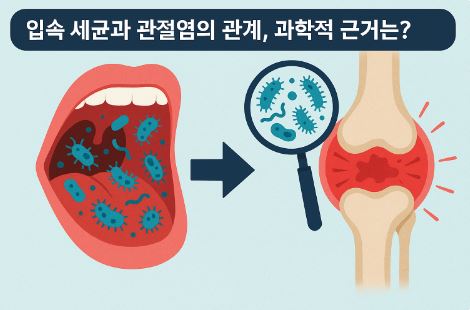 입속 세균과 관절염의 관계, 과학적 근거는?
