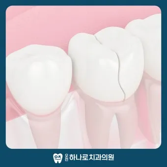 어금니 칫솔 사용법 선택방법 실사용 후기_15