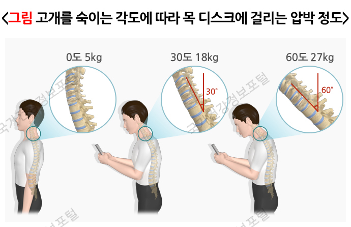 고개각도와 압박정도