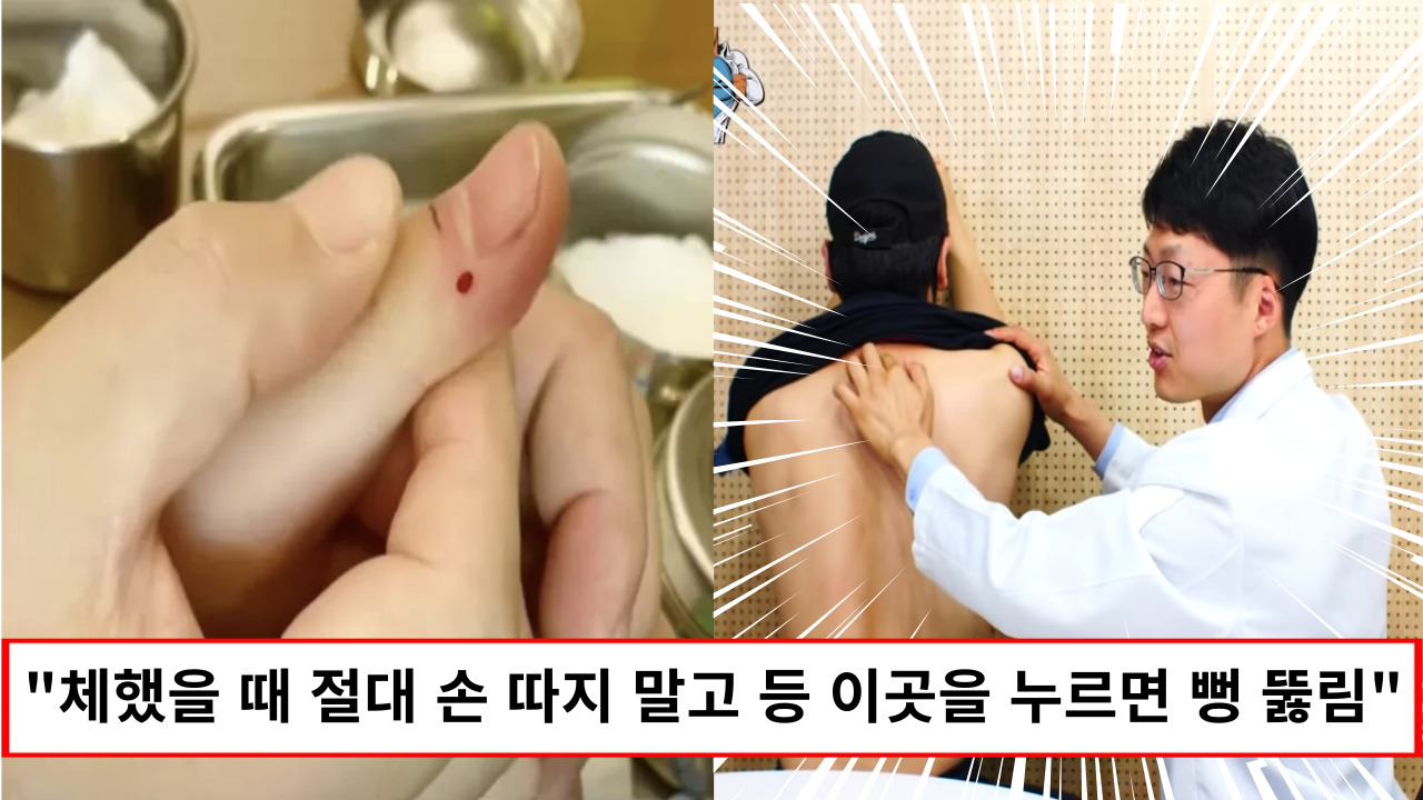 “체했을때 가장 효과가 좋습니다” 응급의학과 의사가 알려주는 체했을 때 시원하게 뚫리는 사이다 지압법