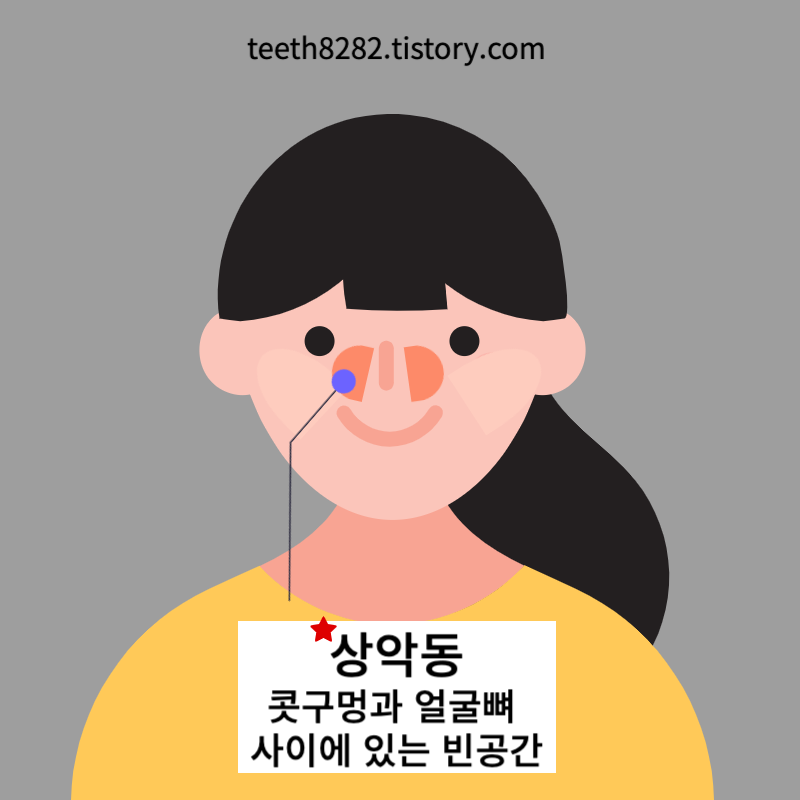 상악동거상술-이란?