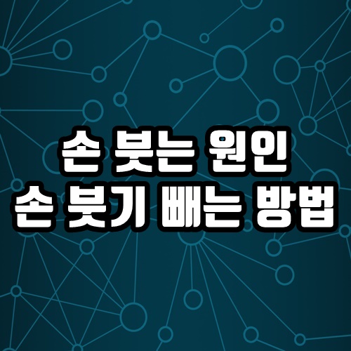  손 붓는 이유와 손 붓기 빼는 방법 함께 알아 볼까요?