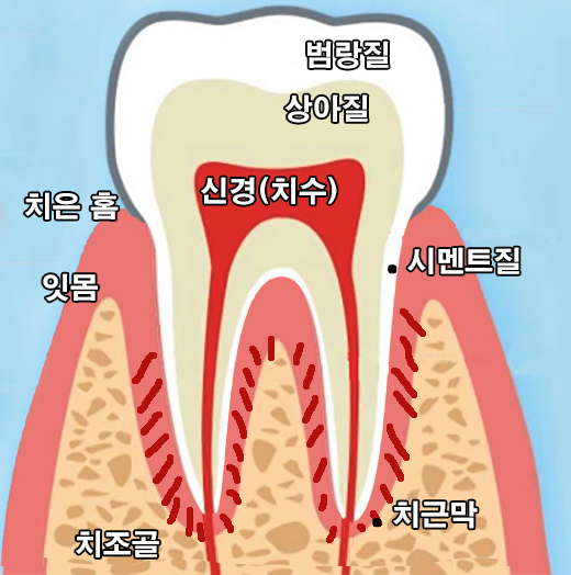 잇몸 퇴축 원인
