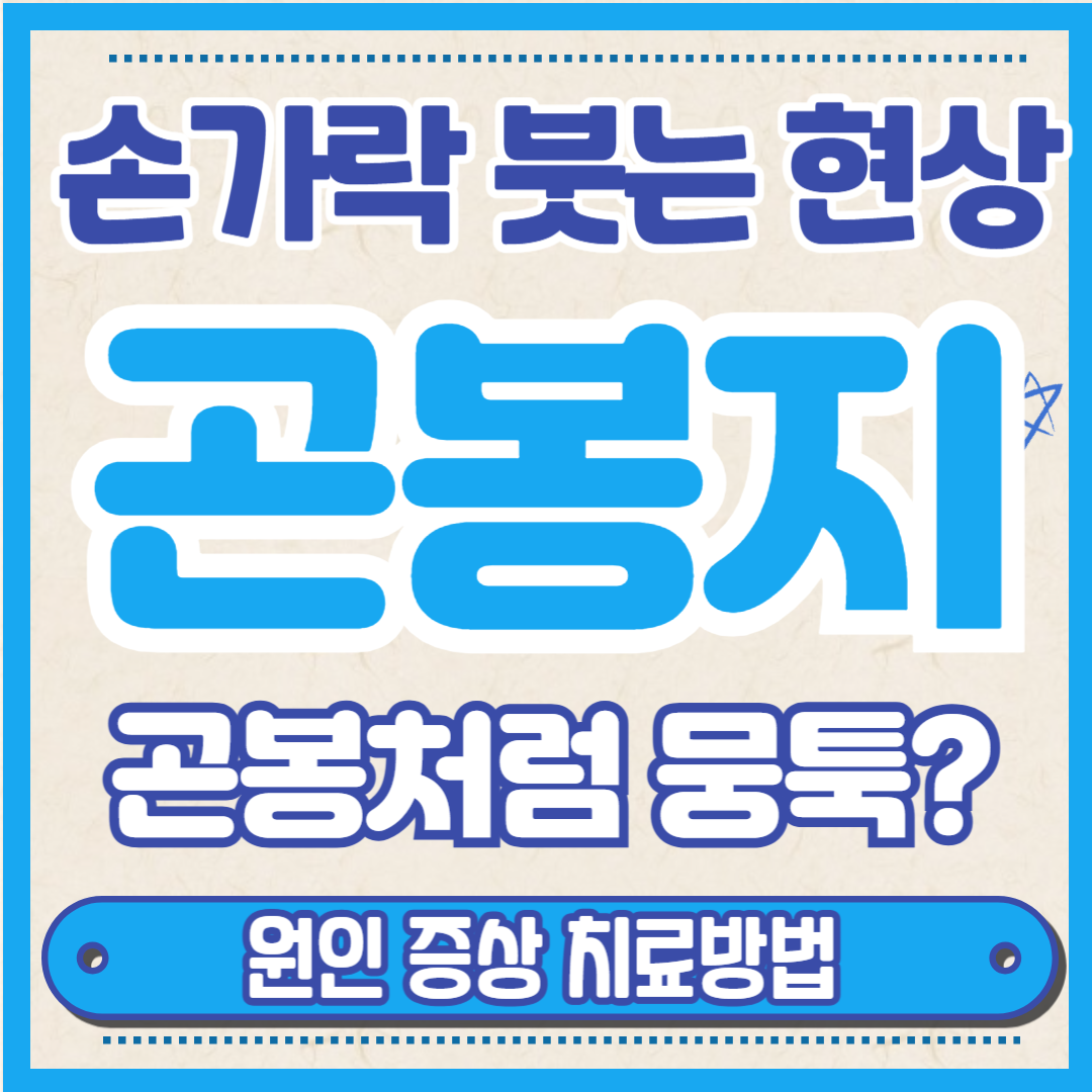곤봉지 손가락,폐암 곤봉지,손톱 곤봉지,곤봉지 발가락,곤봉지 현상,곤봉지상,곤봉지 원인,곤봉지 손톱,곤봉지 폐암,곤봉지 디시,곤봉지 치료,곤봉지 뜻,곤봉진,곤봉지 테스트,곤봉지 증상,곤봉지 초기,곤봉지 기전,곤봉지 나무위키,곤봉지 진단,곤봉지현상,폐암 초기증상,폐암 증상,폐암 4기 생존율,폐암에 좋은 음식,폐암 검사,폐암 4기,폐암 1기,폐암 전이,폐암 기침,폐암증세,폐암 수술,폐암 생존율,폐암 원인,폐암 치료,폐암 항암치료,폐암 종류,폐암 표적치료제,폐암 신약,폐암 유전,폐암 치료제,폐암 병원,폐암 완치,폐암 수술과정,폐암4기 생존기간,폐암에 좋은 음식 10,폐암3기 생존기간,폐암 검사방법,폐암 말기암 환자 임종전 증상,폐암 말기 증상,폐암 명의,폐암 수술후 회복기간,폐암2기 생존율,폐암 초기증상 잔기침,폐암 1기 증상,폐암 3기 얼마나 살수 있나요,폐암4기 완치사례,폐암 단계별 증상,폐암 증상 어깨,폐암 초기증상 자가진단,폐암학회,폐암 4기 증상,폐암 통증 부위,폐암 4기 시한부,폐암초기증상,폐암 증상과 징후,폐암2기생존율,폐암4기생존율,폐암초기 증상 왼쪽 겨드랑이,폐암 수술 후 생존기간 및 완치율,폐암에 좋은 음식 10가지,폐암에좋은음식,폐암 명의 심영목 교수,이혜영 폐암,폐암1기생존율,폐암 면역항암제 치료법,폐암 산재인정 조건,폐암 3기 생존율,폐암 증상 기침 체중감소 입맛,폐암 표적항암치료제,폐암 전이 생존율,폐암4기증상,폐암전문병원,폐암 조직검사방법