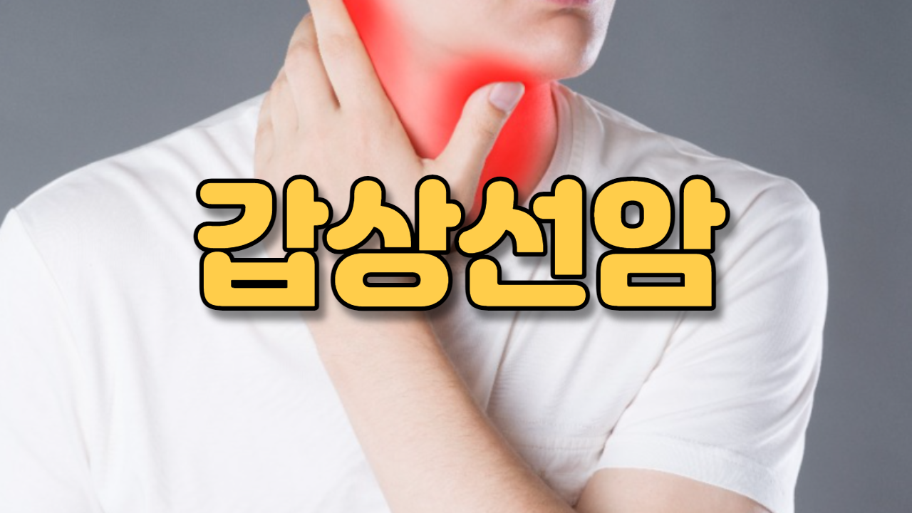  갑상선암