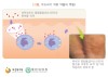  갑자기 두드러기로 가려우면 코로나 바이러스 일수 있다?!