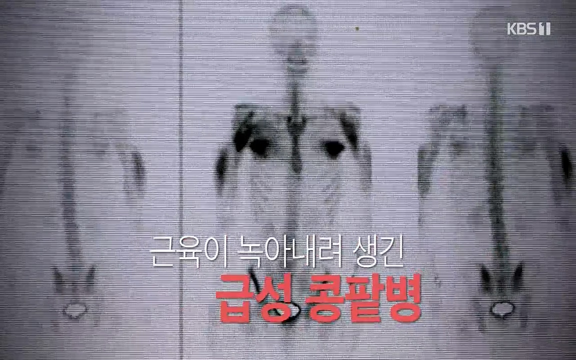 생로병사의 비밀.E819.220421p-NEXT.mp4_20220421_190813.617.jpg