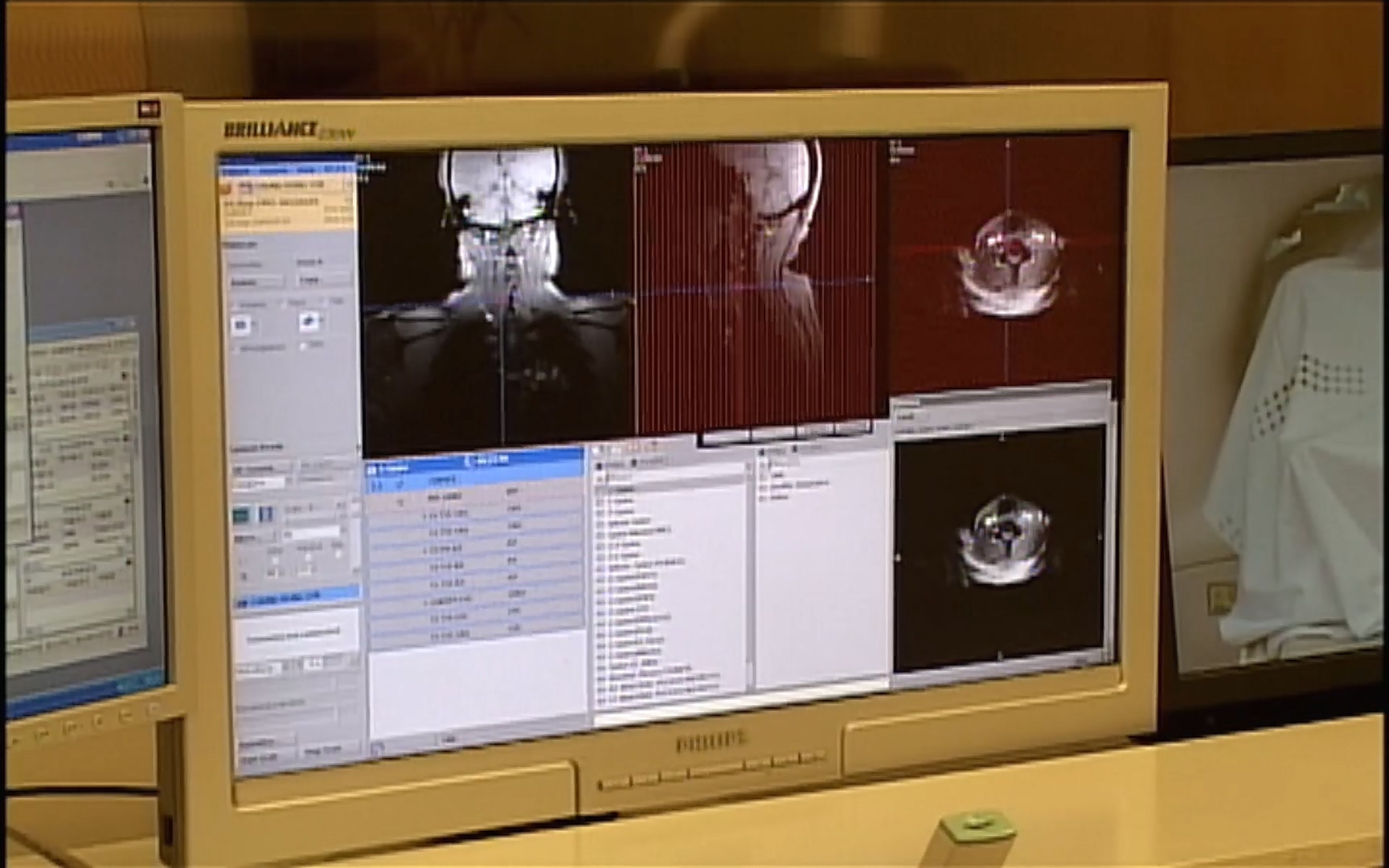 EBS 명의 헬스케어 - TV - 교육의 중심 EBS50대의 공포, 오십견 - 재활의학과 전문의 이강우 교수.mp4_20220913_202324.528.jpg