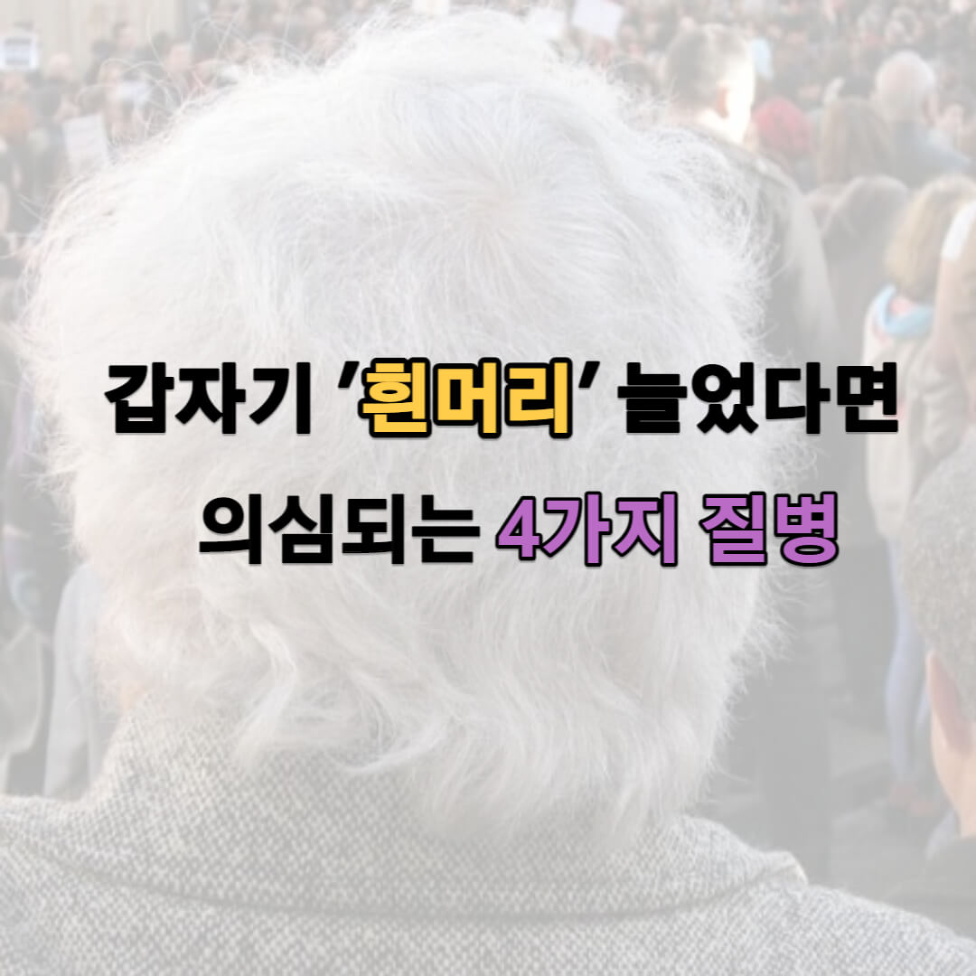 흰머리로 의심되는 질환
갑자기 &#39;흰머리&#39; 늘었다면 의심되는 4가지 질병