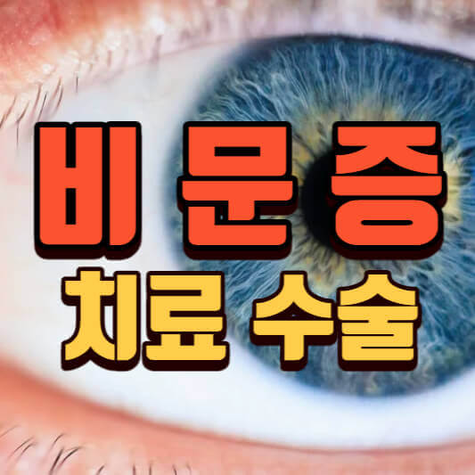 비문증(눈 날파리증) 치료 수술 원인 쉽게정리