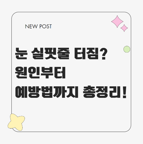 눈 실핏줄 터짐의 원인과 자가 치료 및 예방법을 설명하는 이미지
