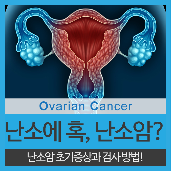  난소암 초기증상과 검사방법을 알아보자