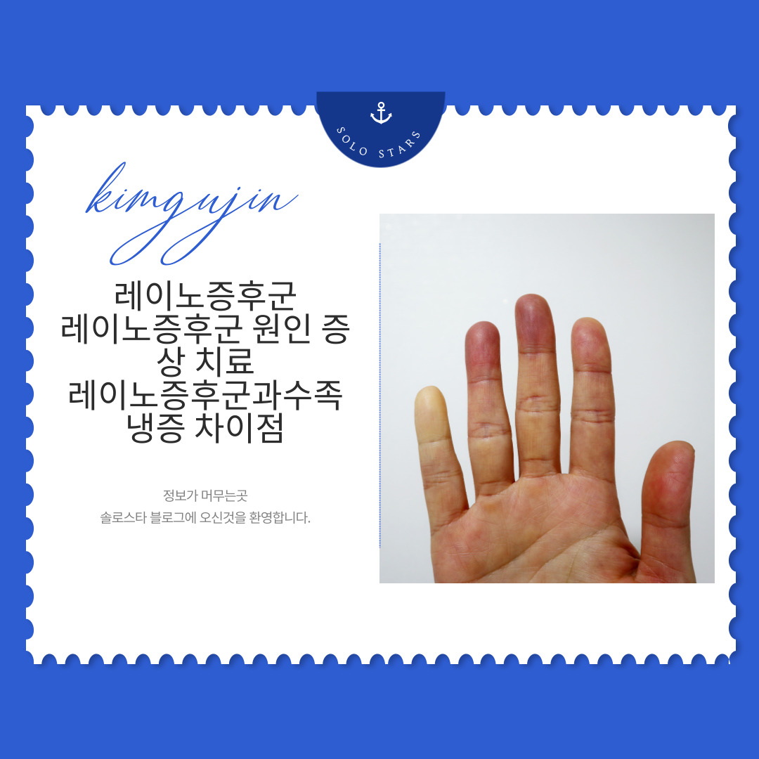 레이노증후군 사진