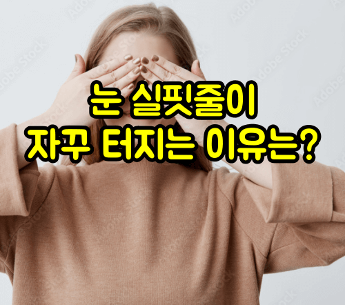 눈 실핏줄이 자꾸 터지는 이유