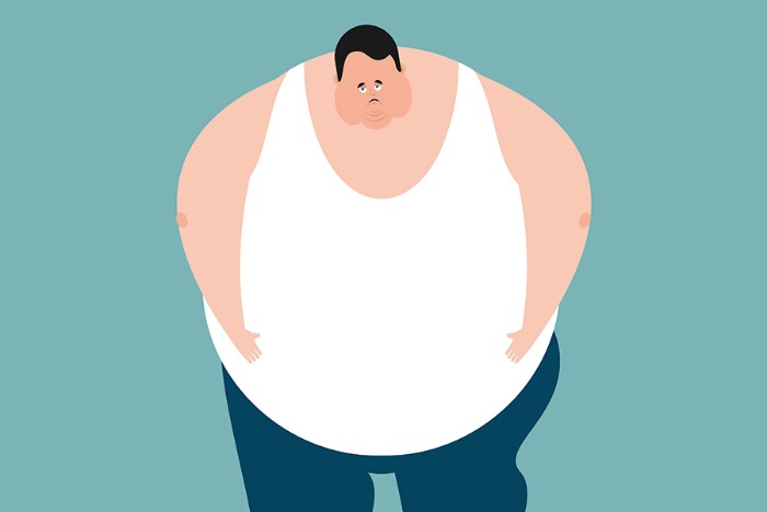  고도비만은 합병증의 지름길 바로 관리하자