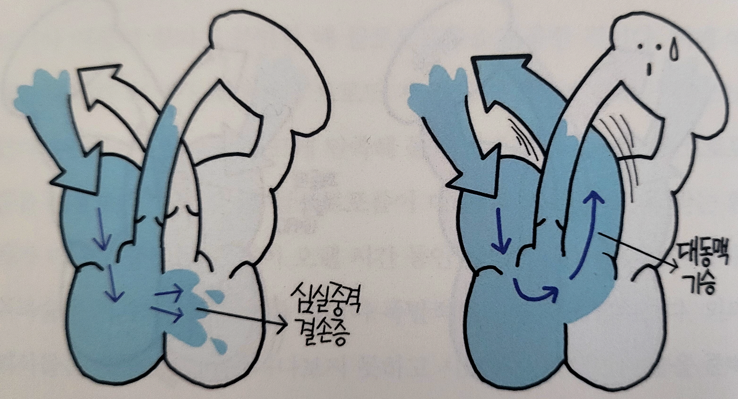 팔로인 이미지