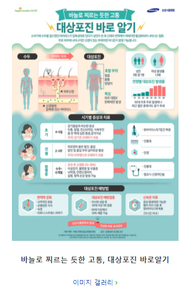 대상포진 초기증상