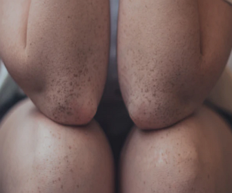 무릎관절에 좋은 음식 related image 14