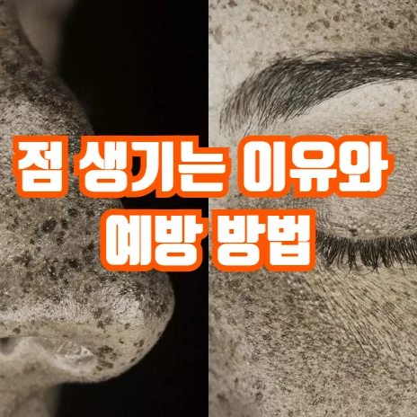 점 생기는 이유