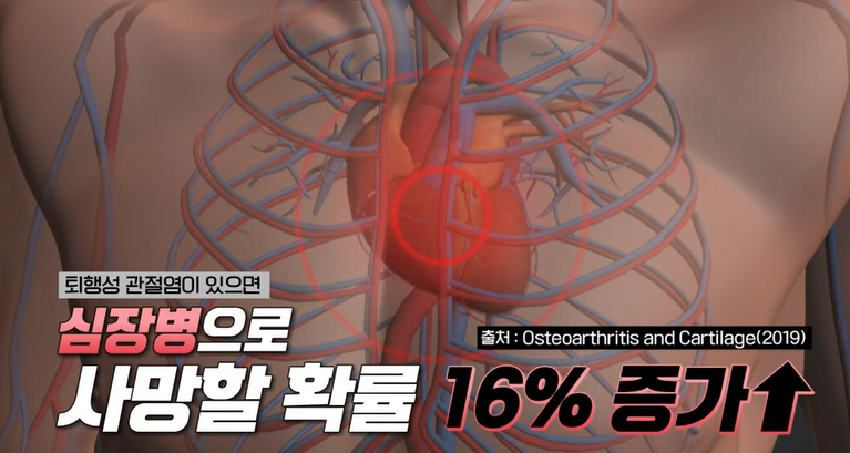콘드로이친