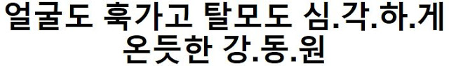  이.번에 얼..굴도 훅.가고 탈.모도 심..각하게 온 강.동.원