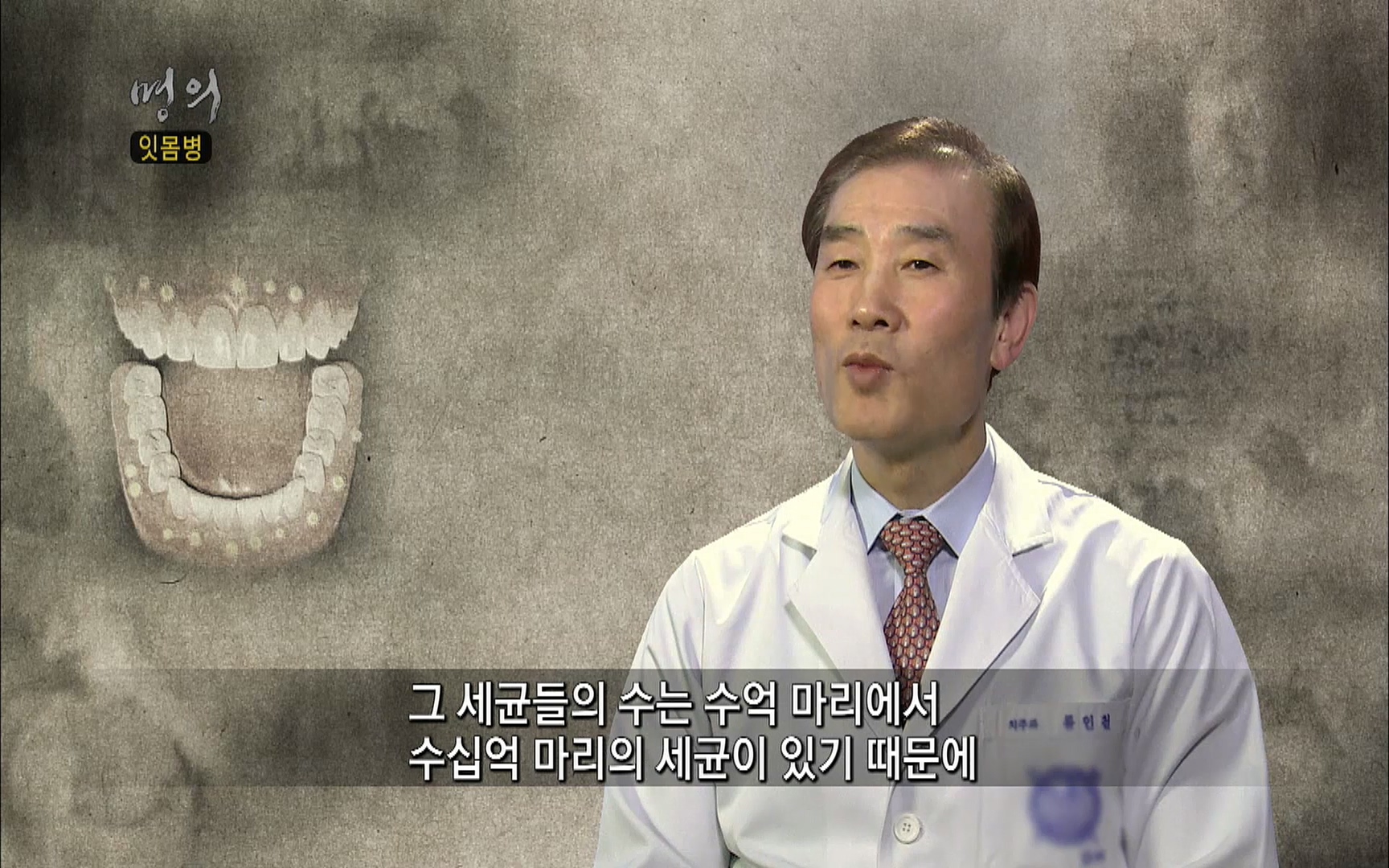 EBS 명의 헬스케어 - TV - 교육의 중심 EBS2015년 1월 16일 (금) 밤 9시 50분, EBS1.mp4_20220505_150400.713.jpg