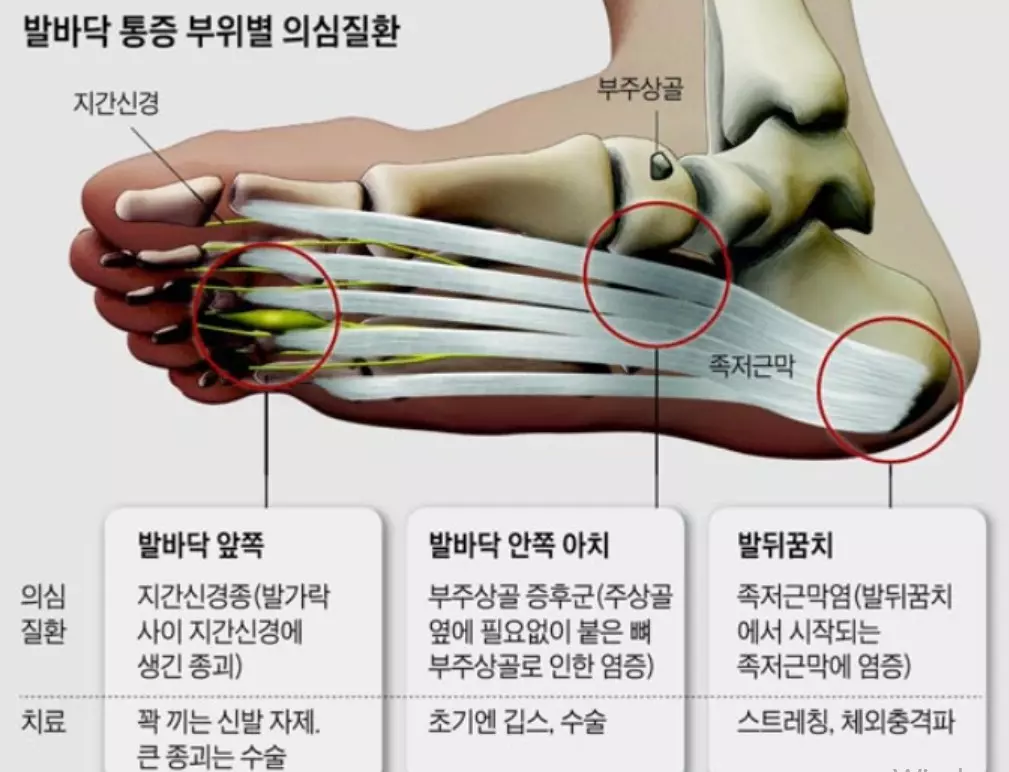 구별 방법