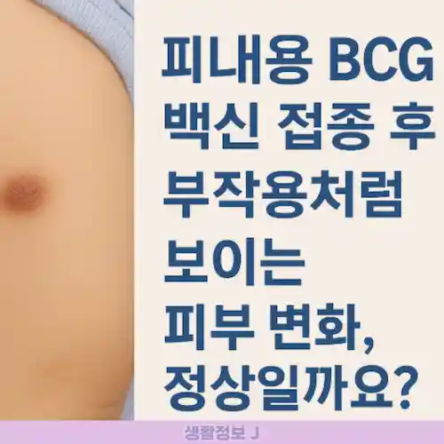 피내용 BCG 백신 접종 후, 시기별 사진과 비교 정리 썸네일