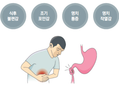 소화불량 해결의 첫걸음