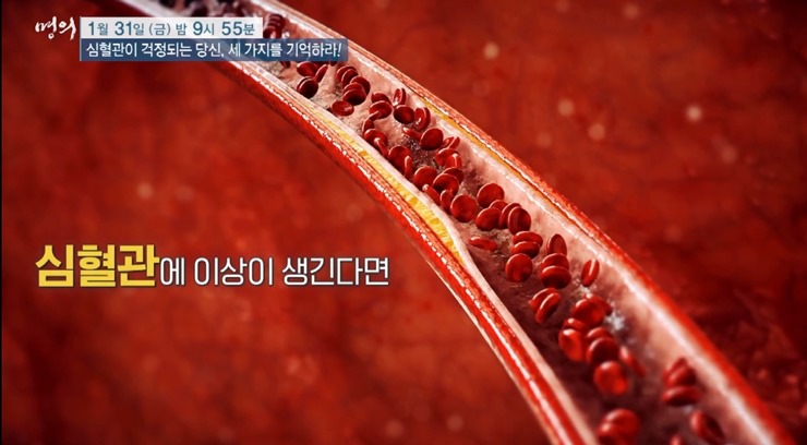 혈관-안에-찌꺼기