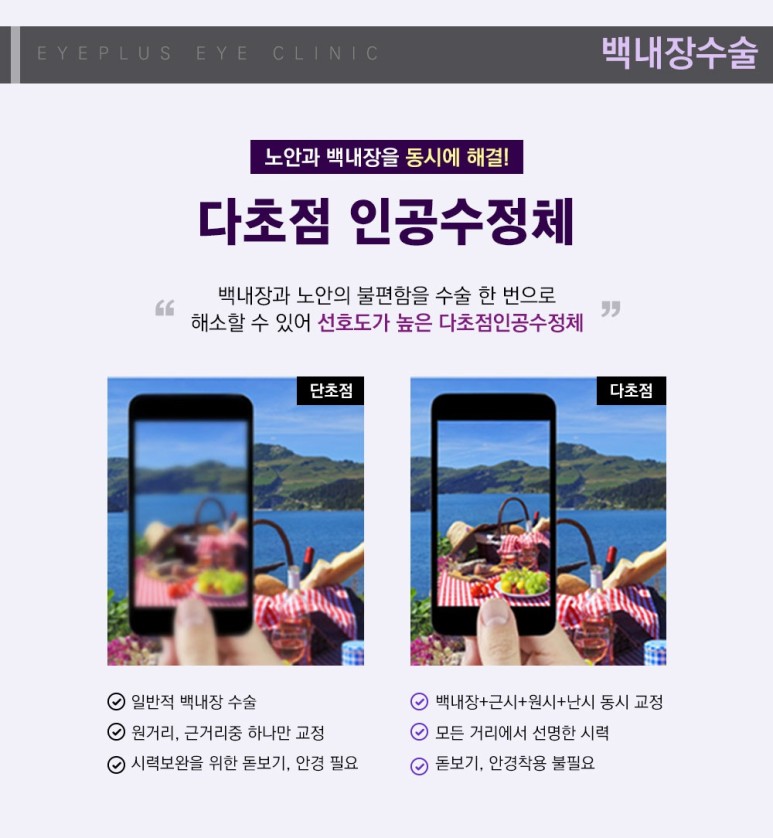 ●미리 막으려면 백내장 수술 부작용