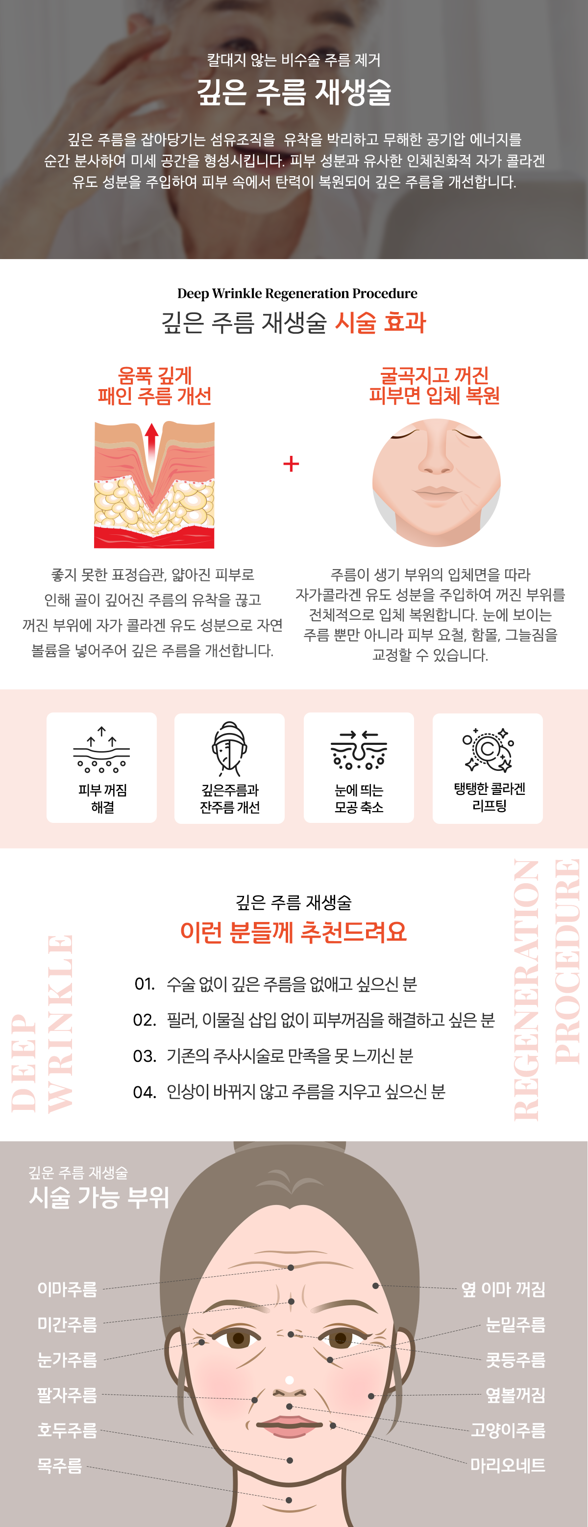 압구정 팔자주름 실리프팅 (3).png