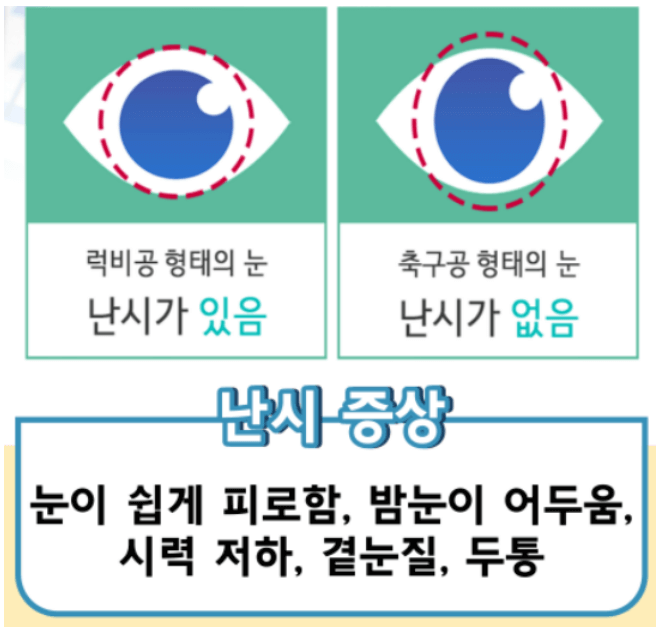 난시 교정수술 비용 치료법