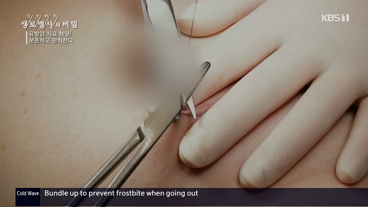 생로병사의 비밀.E845.221131p.H264-F1RST.mp4_20221201_215314.090.jpg