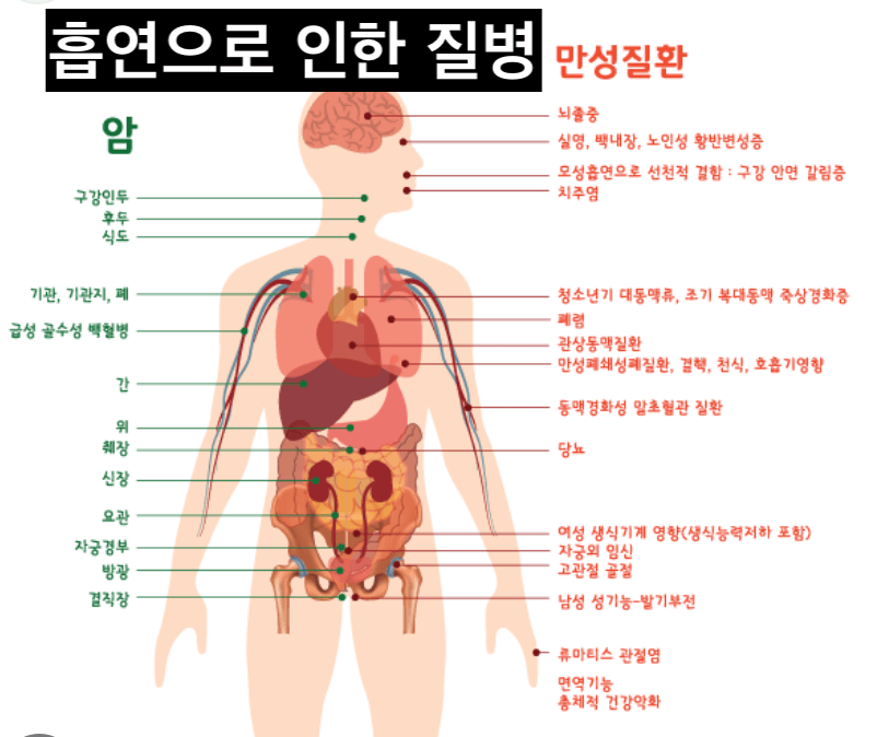 흡연 질병 사진