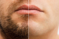 콧수염 제모 수염 왁싱 가격