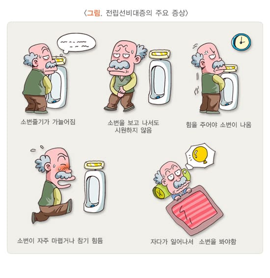 전립선비대증