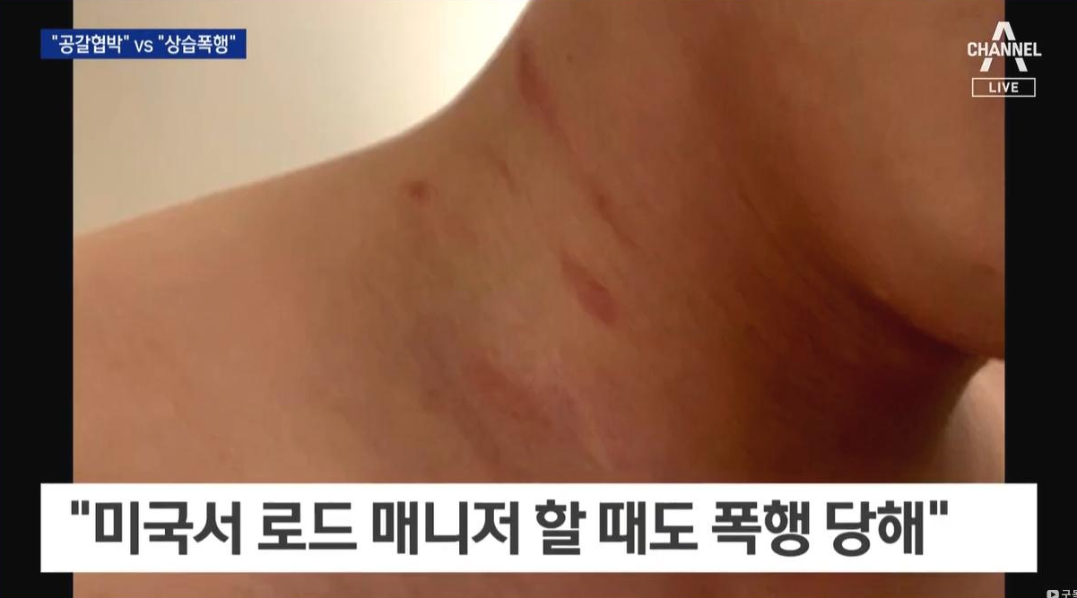 김하성 후배 임모씨 폭행 카톡 사진 가짜 논란 디스패치