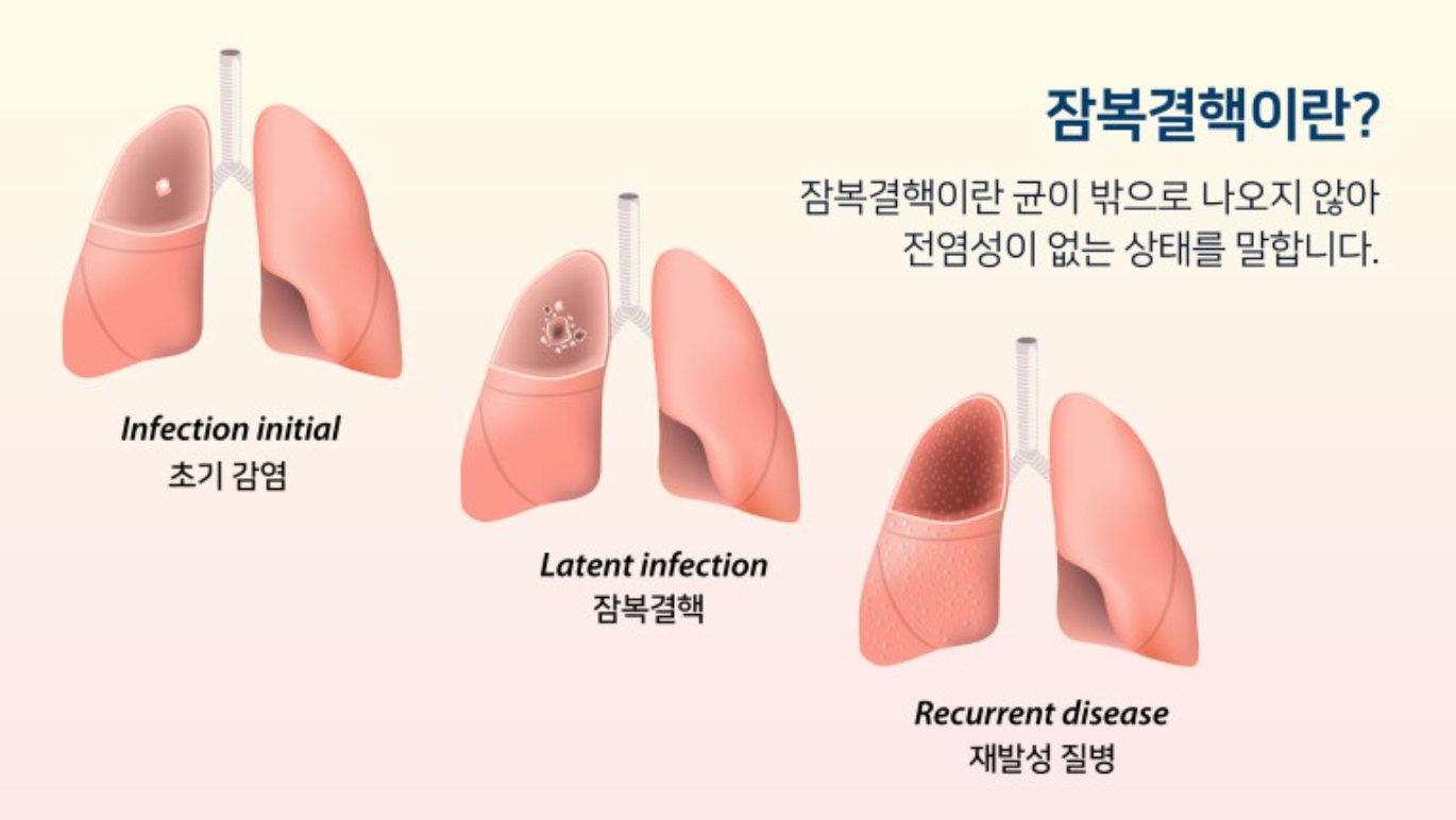  잠복결핵, 증상, 전염검사, 잠복결핵 확인서 발급