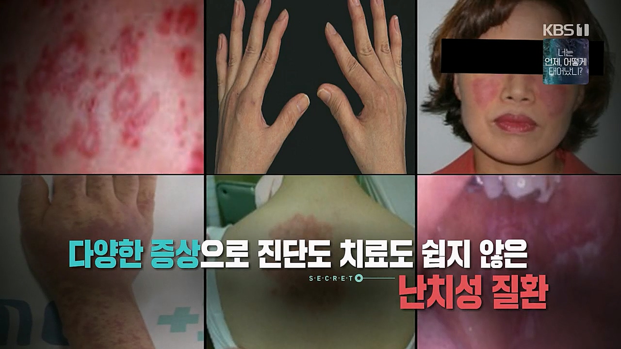 생로병사의 비밀.E860.230316p.H264-F1RST.mp4_20230316_212743.217.jpg