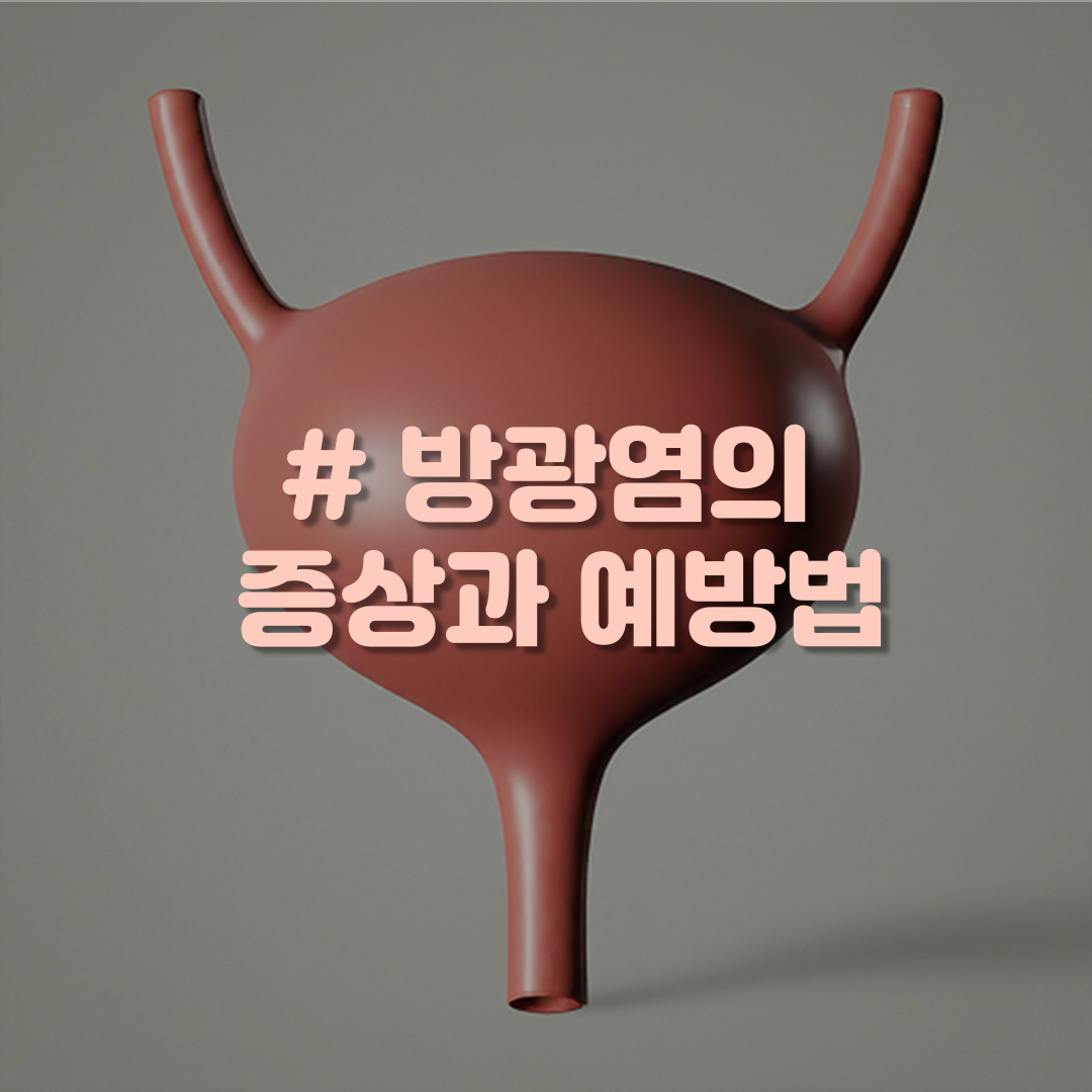 방광염의 증상과 예방법