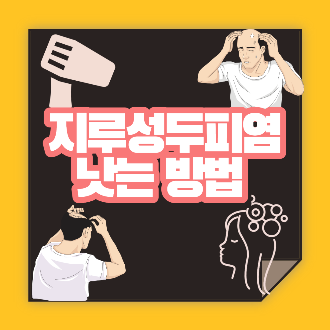  지루성 두피염 샴푸 추천 + 낫는 방법 확실하게 공개합니다.