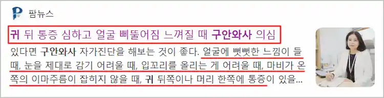 구안와사 증상 기사