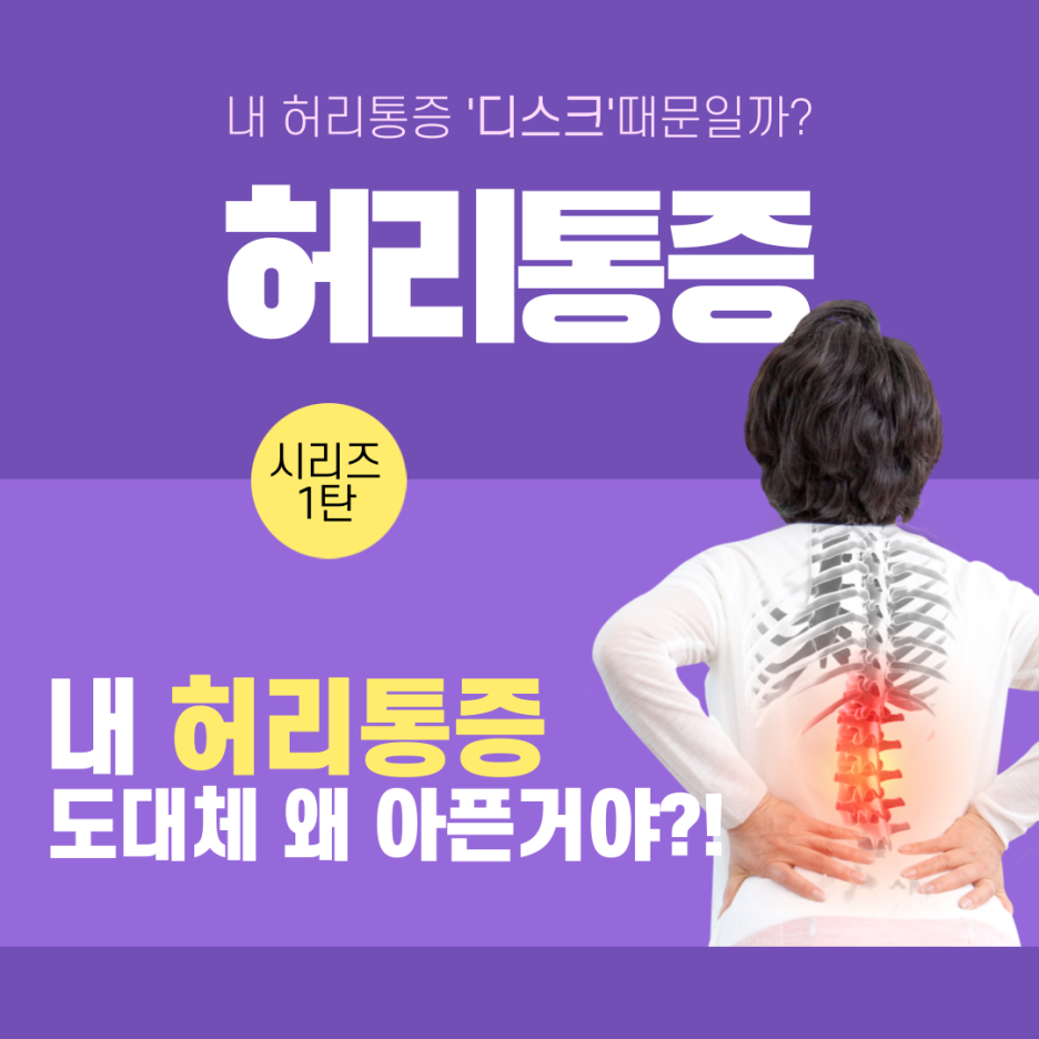  허리디스크) 내 허리통증 '디스크'때문일까?