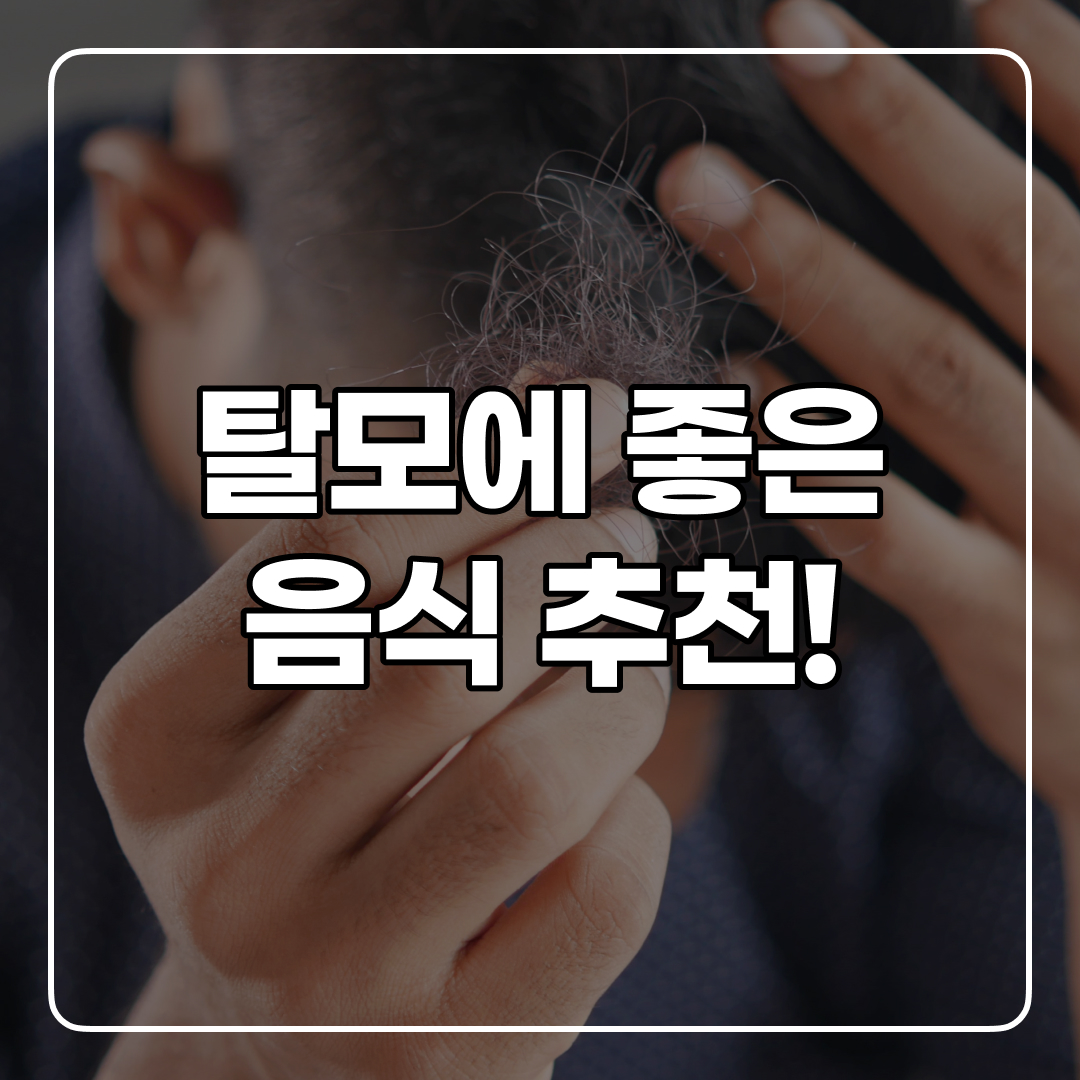  탈모 예방에 좋은 음식 5개 추천!