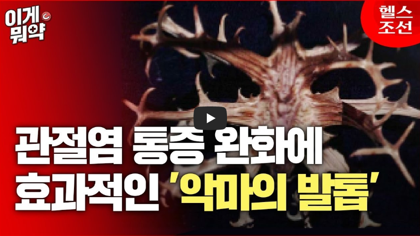 관절염 통증 완화 사진