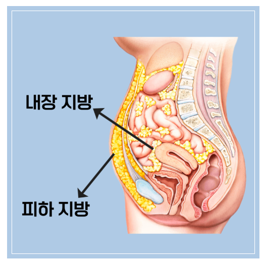 내장지방