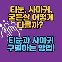  티눈, 사마귀, 굳은살 어떻게 다를까? 티눈과 사마귀 구별하는 방법!