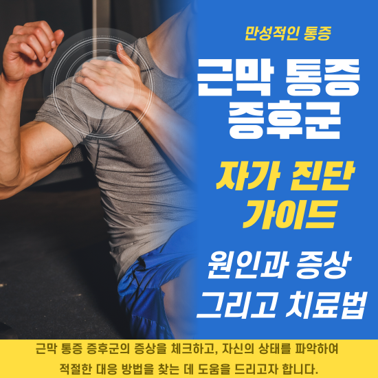 근막 통증 증후군