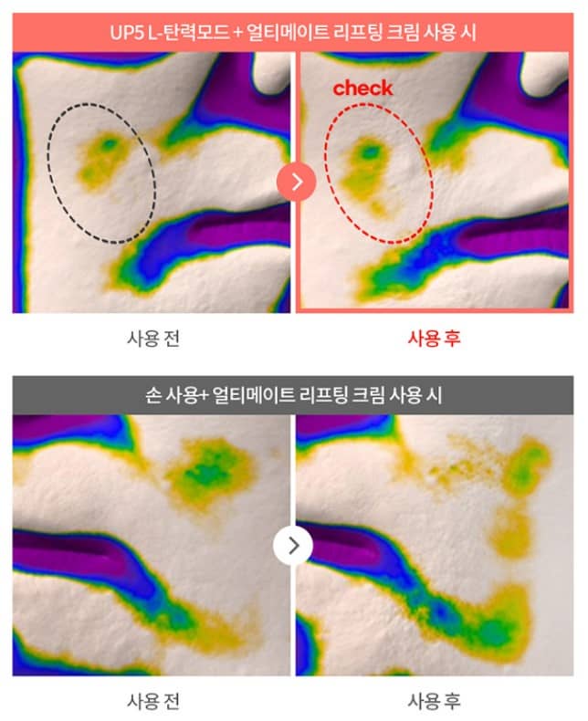 바나브 up5 부작용